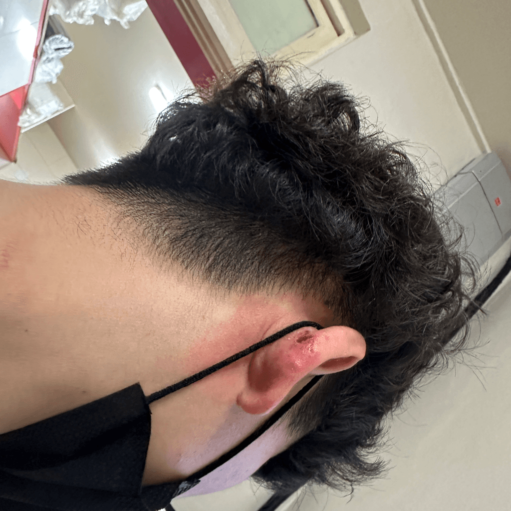 1번 째 사진