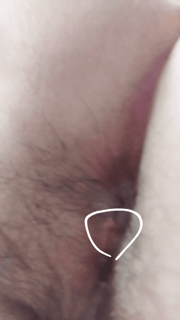 2번 째 사진