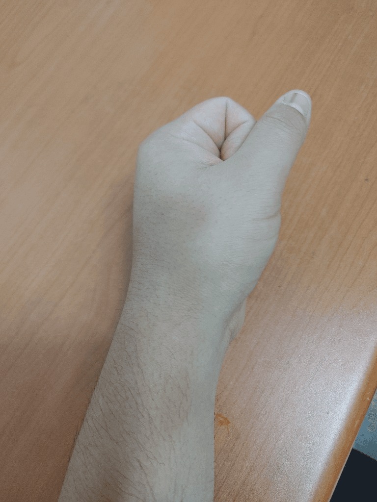 2번 째 사진
