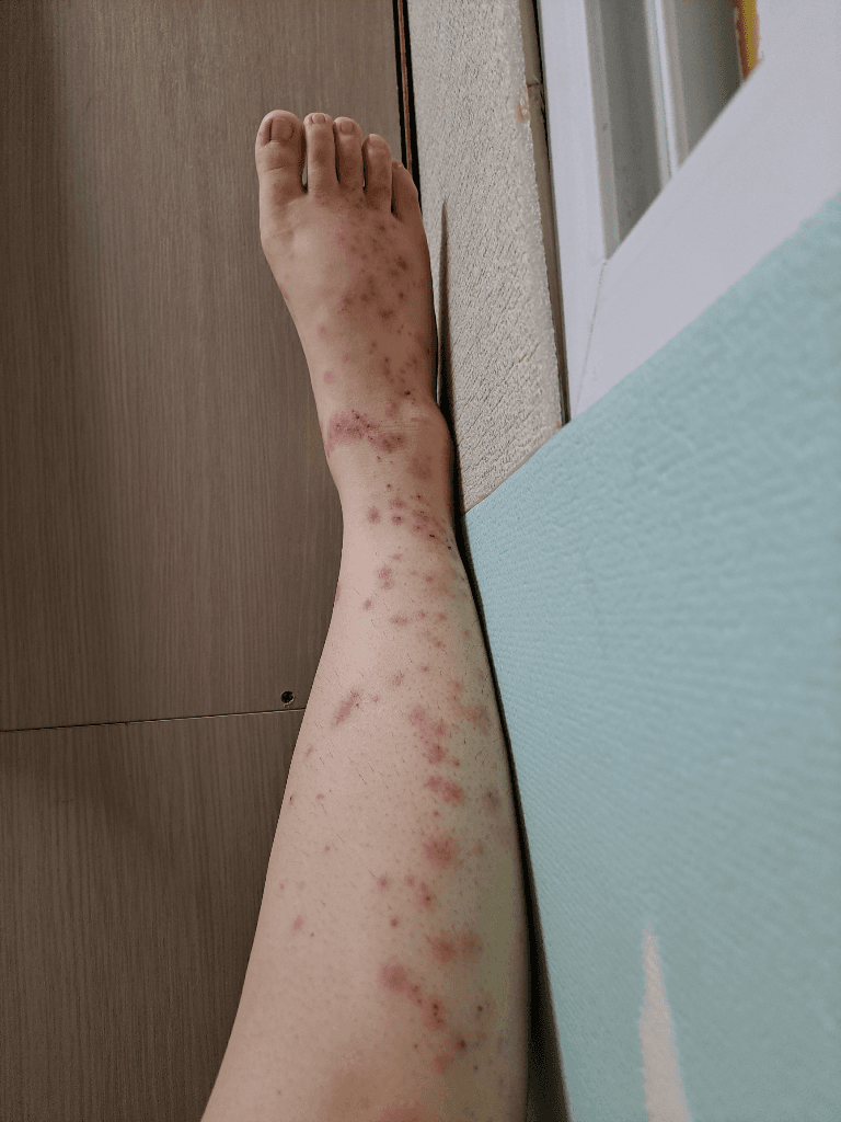 3번 째 사진