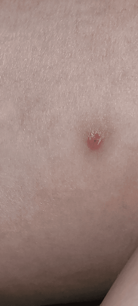 8번 째 사진