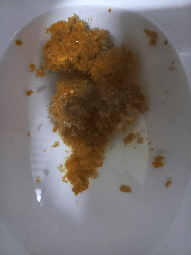 2번 째 사진