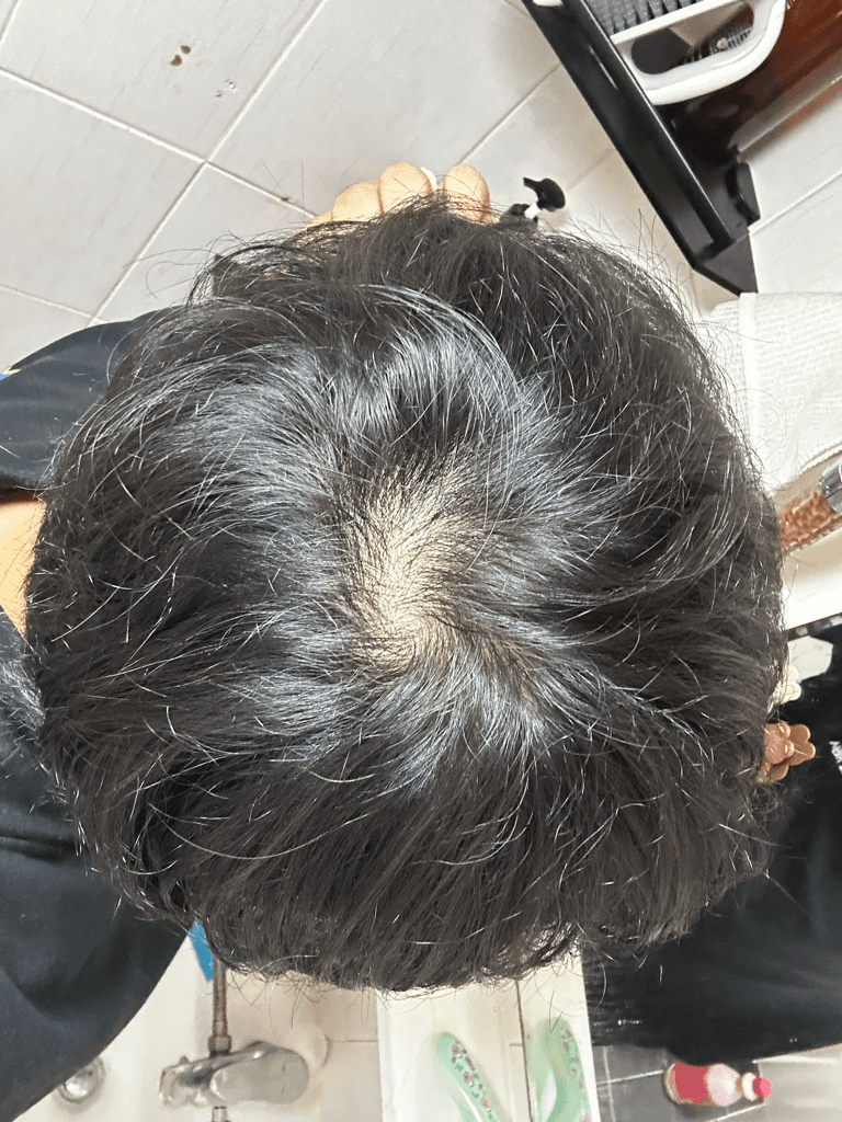 2번 째 사진