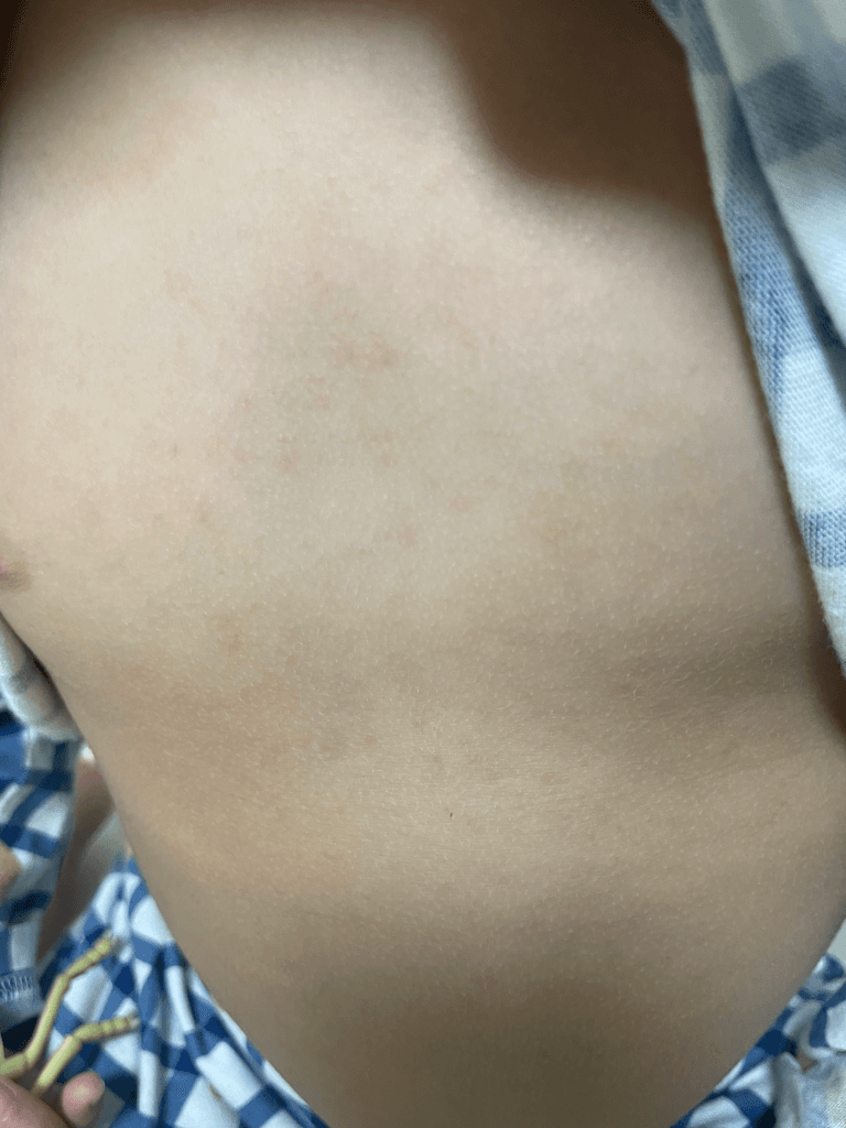 2번 째 사진