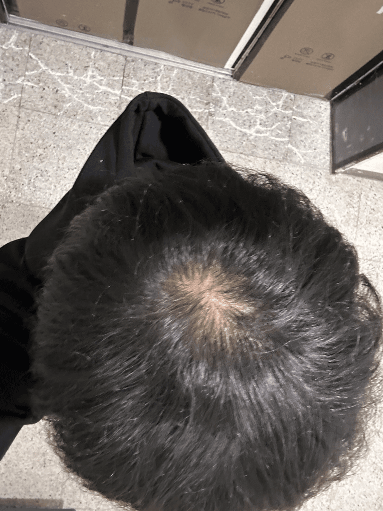 2번 째 사진