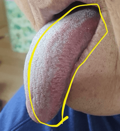3번 째 사진