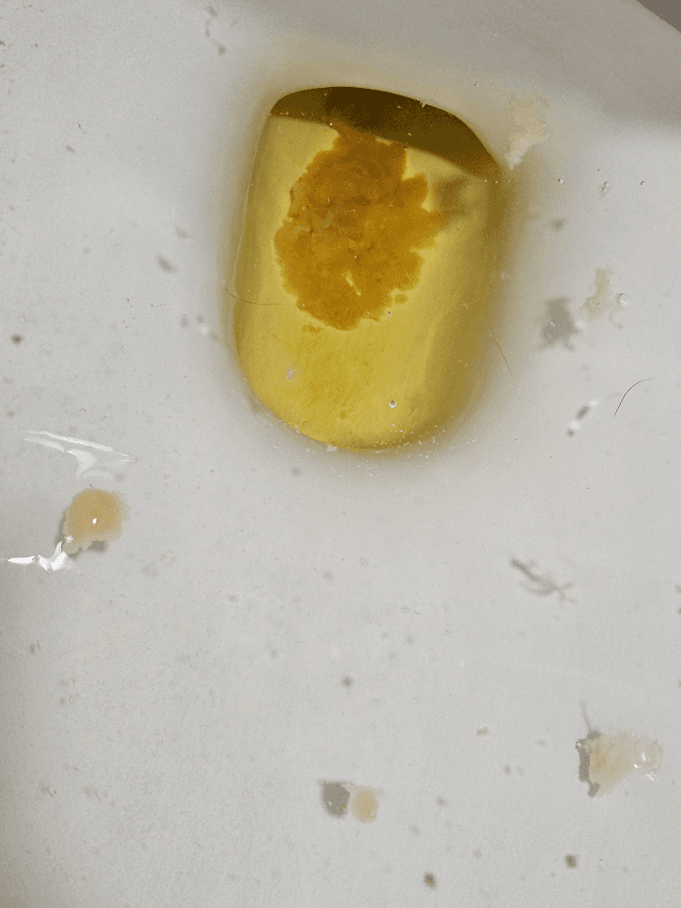 2번 째 사진