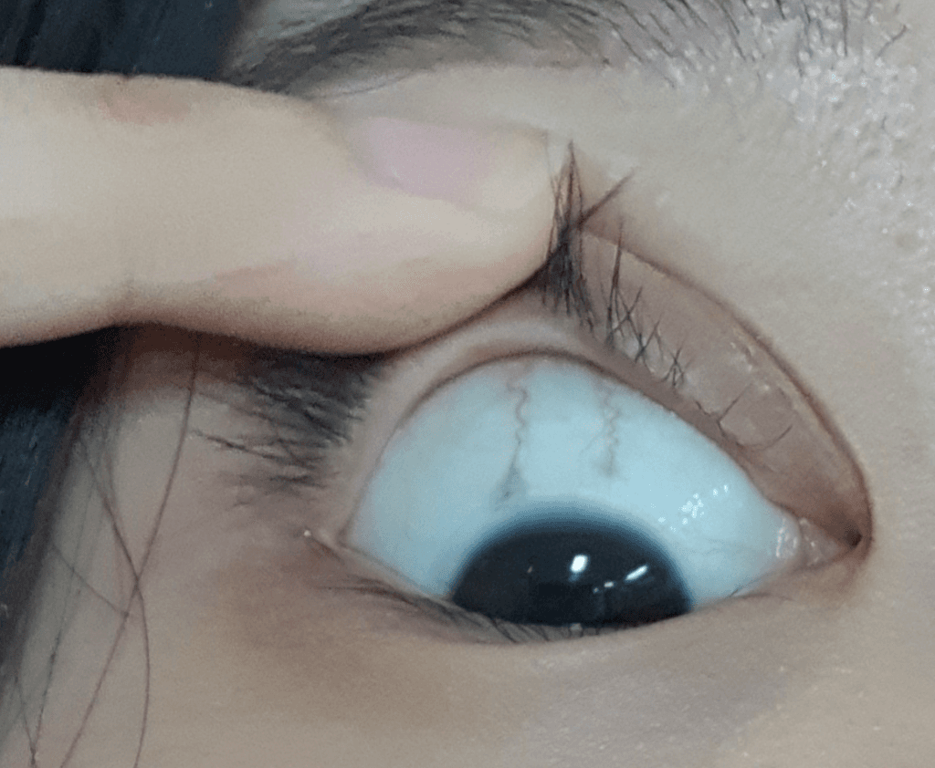 2번 째 사진