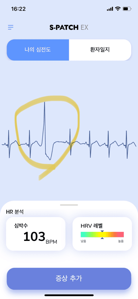 2번 째 사진