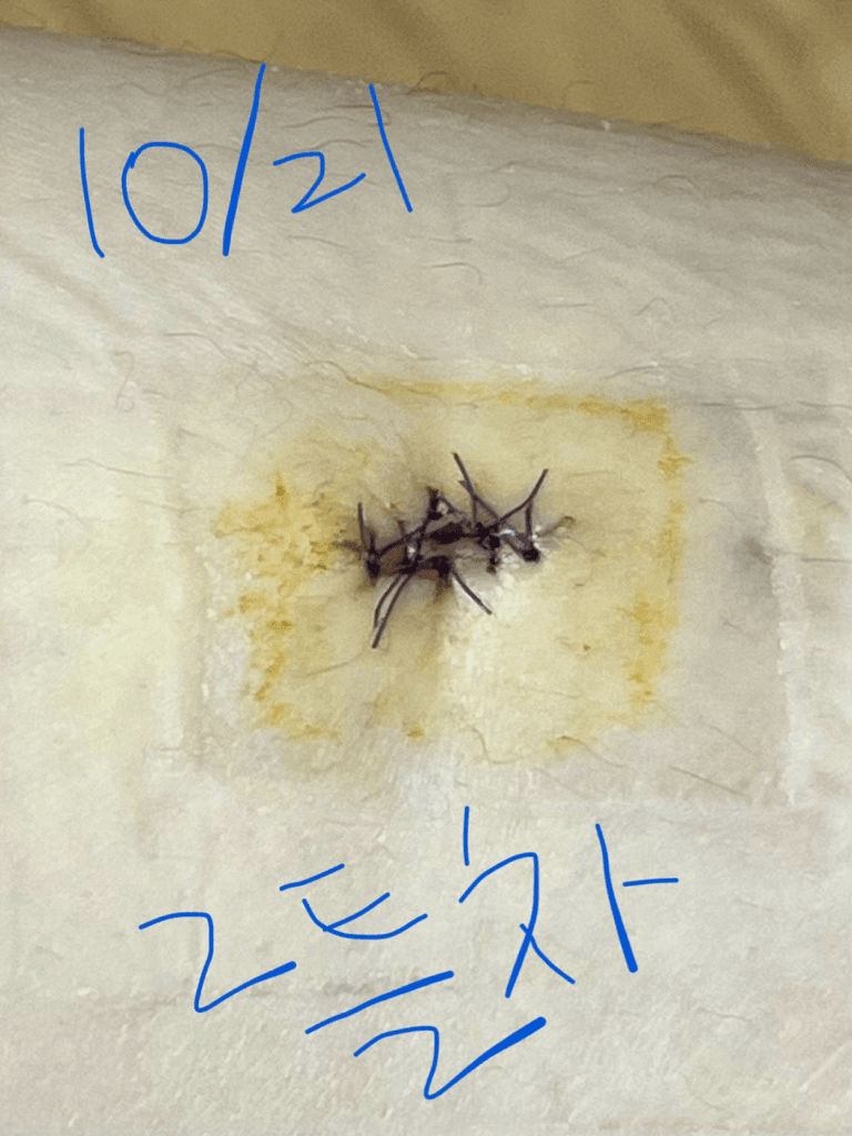 1번 째 사진