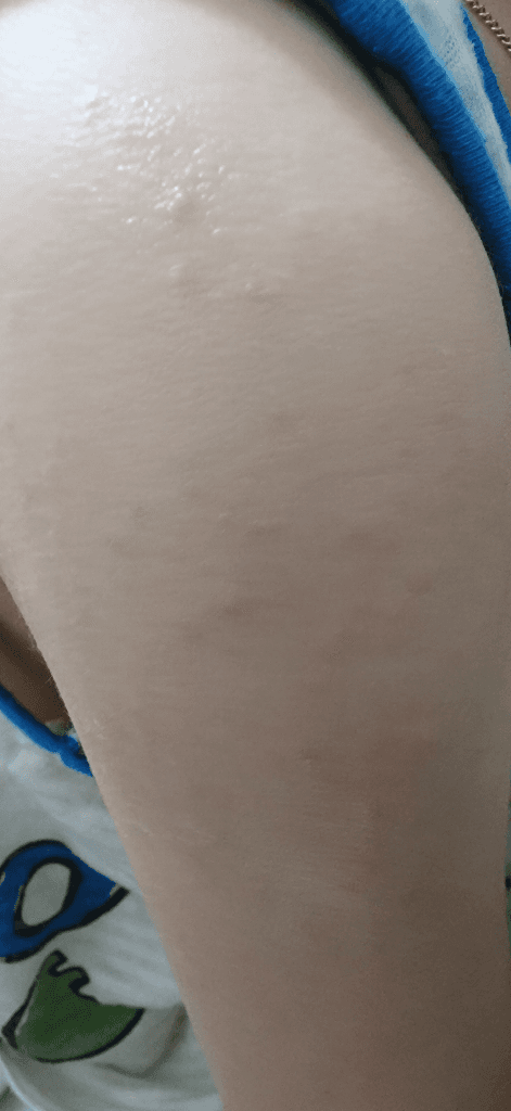 2번 째 사진