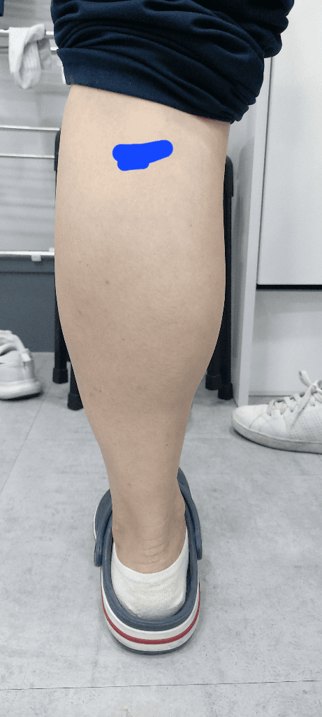1번 째 사진