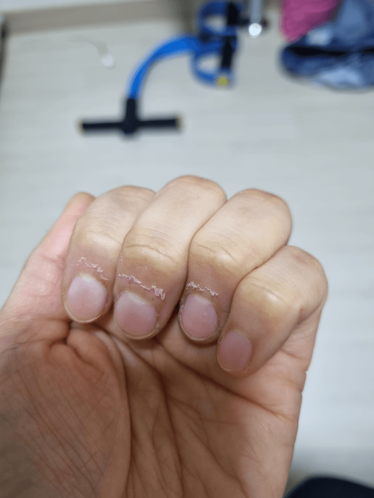 2번 째 사진