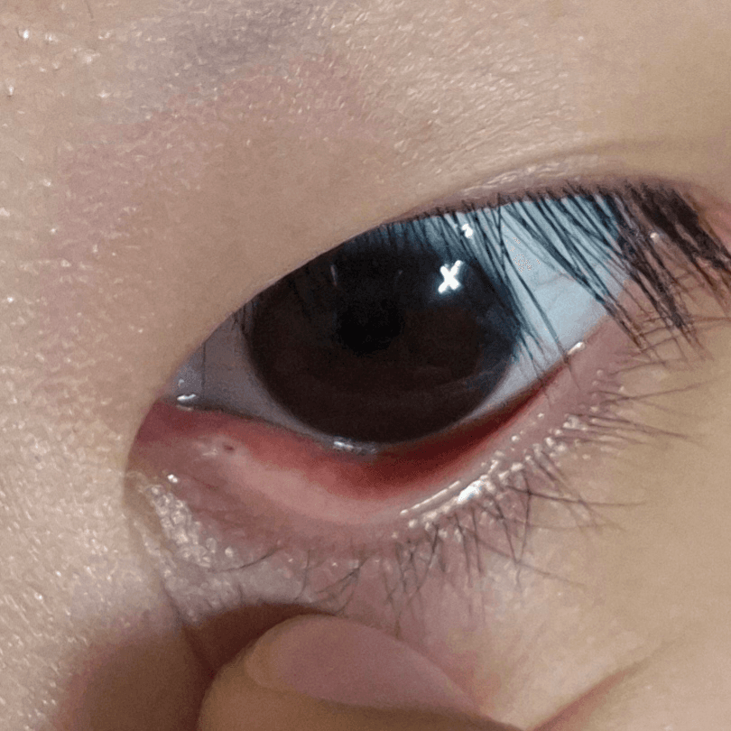 2번 째 사진