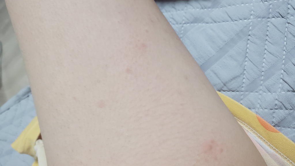 2번 째 사진