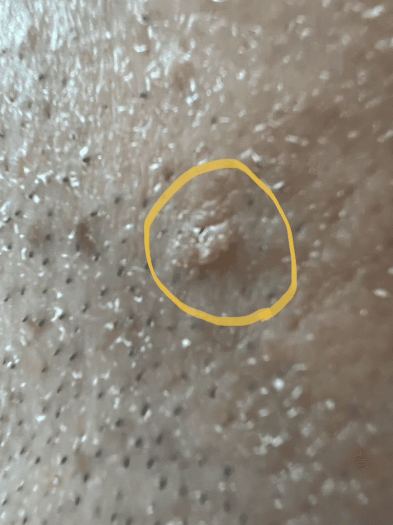 4번 째 사진