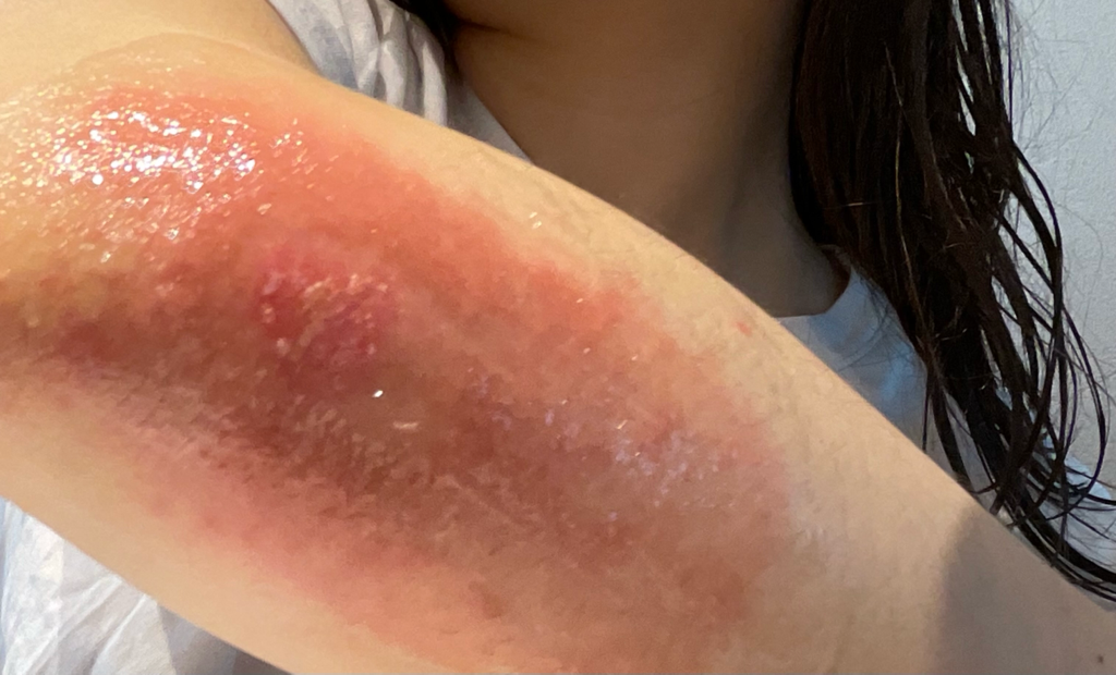 1번 째 사진