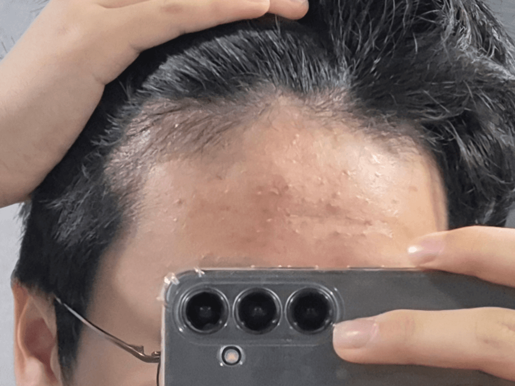 2번 째 사진