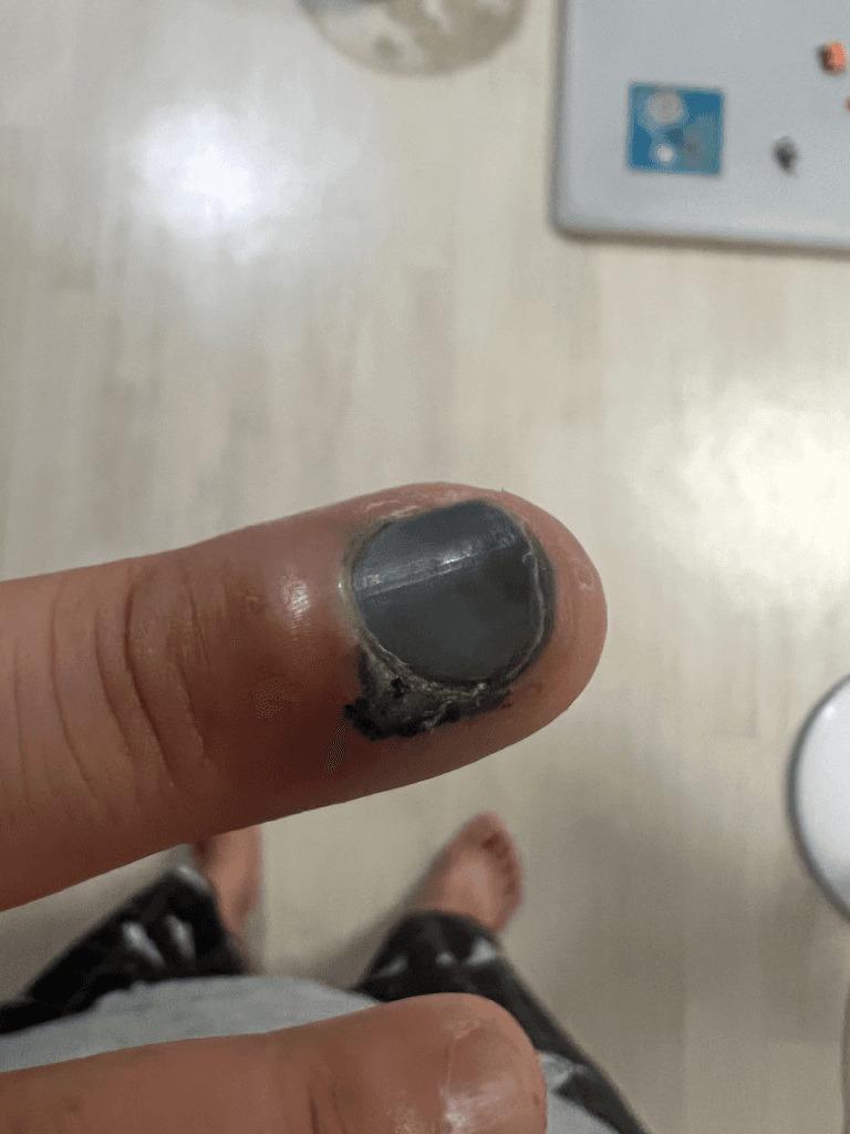 2번 째 사진