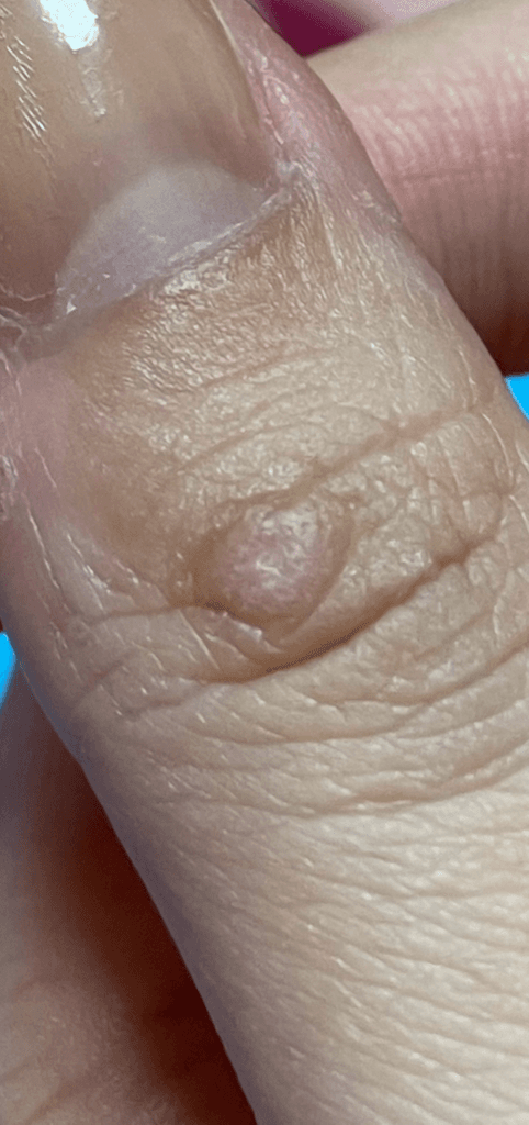 2번 째 사진