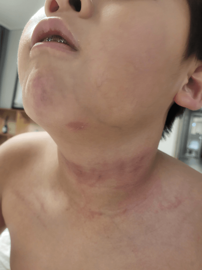 1번 째 사진