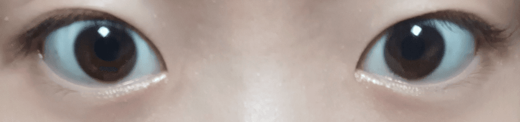 2번 째 사진