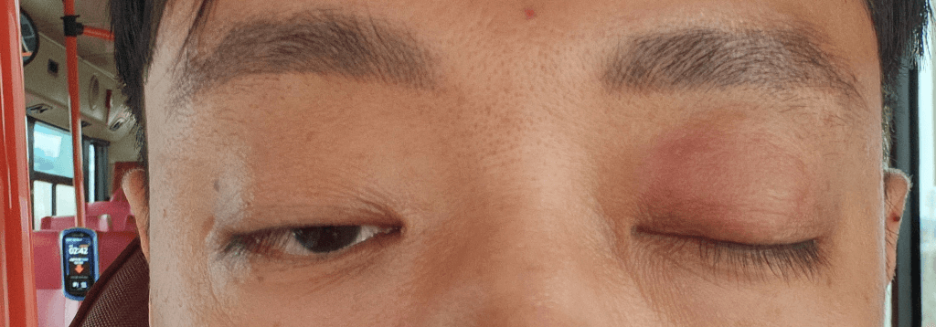 2번 째 사진