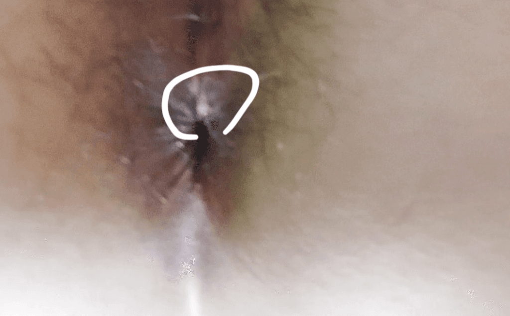 5번 째 사진