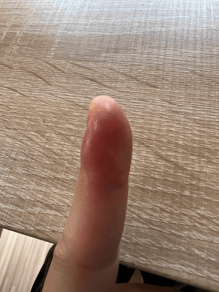 2번 째 사진