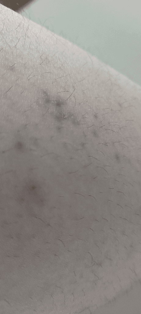 2번 째 사진