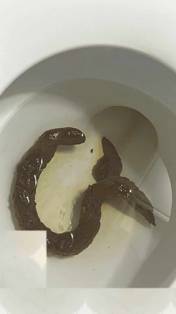 2번 째 사진