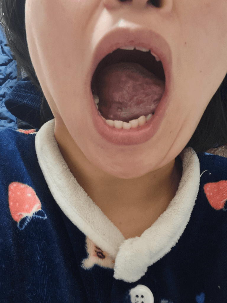 3번 째 사진
