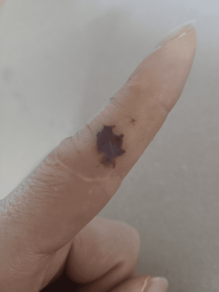 1번 째 사진