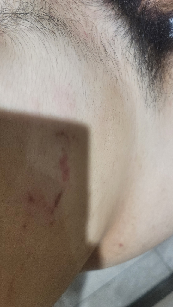2번 째 사진