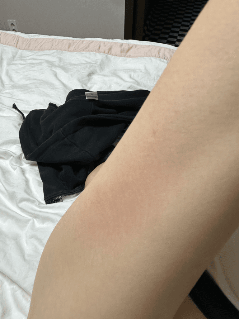 2번 째 사진
