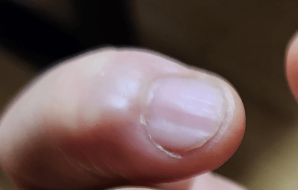 2번 째 사진
