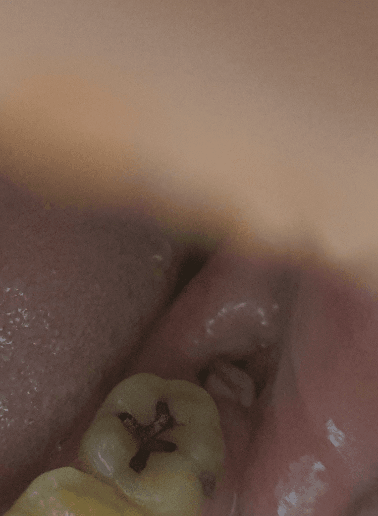 2번 째 사진