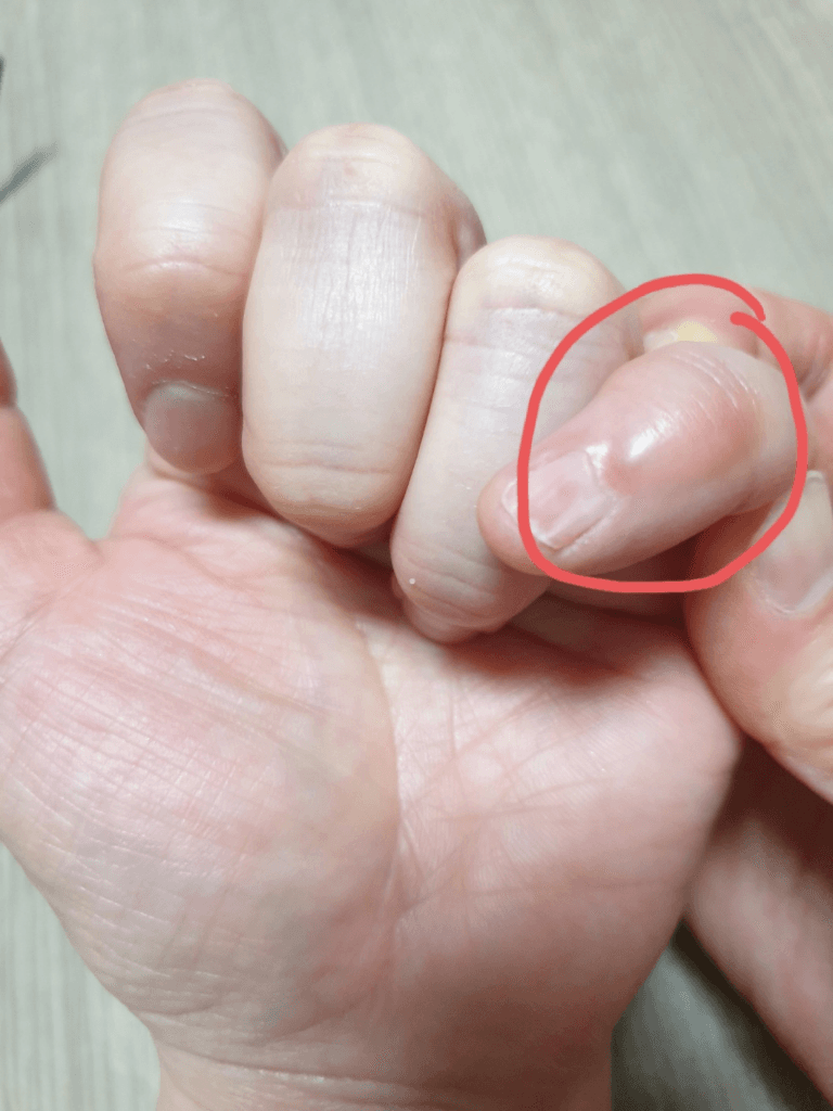 1번 째 사진
