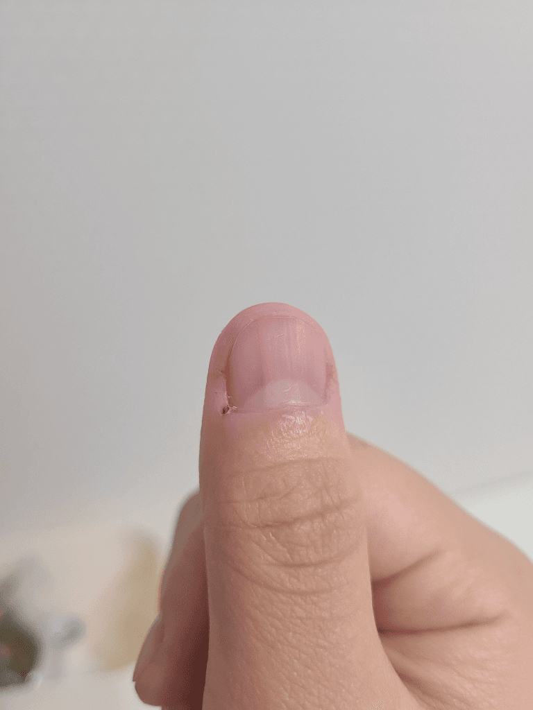 2번 째 사진