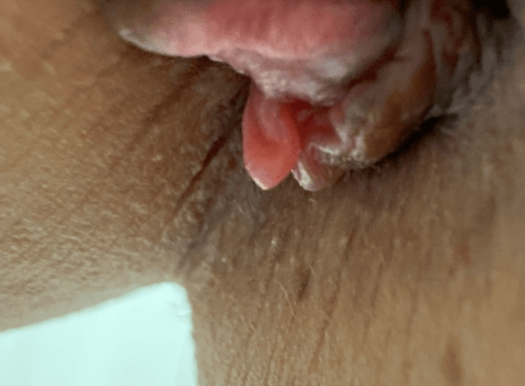 4번 째 사진