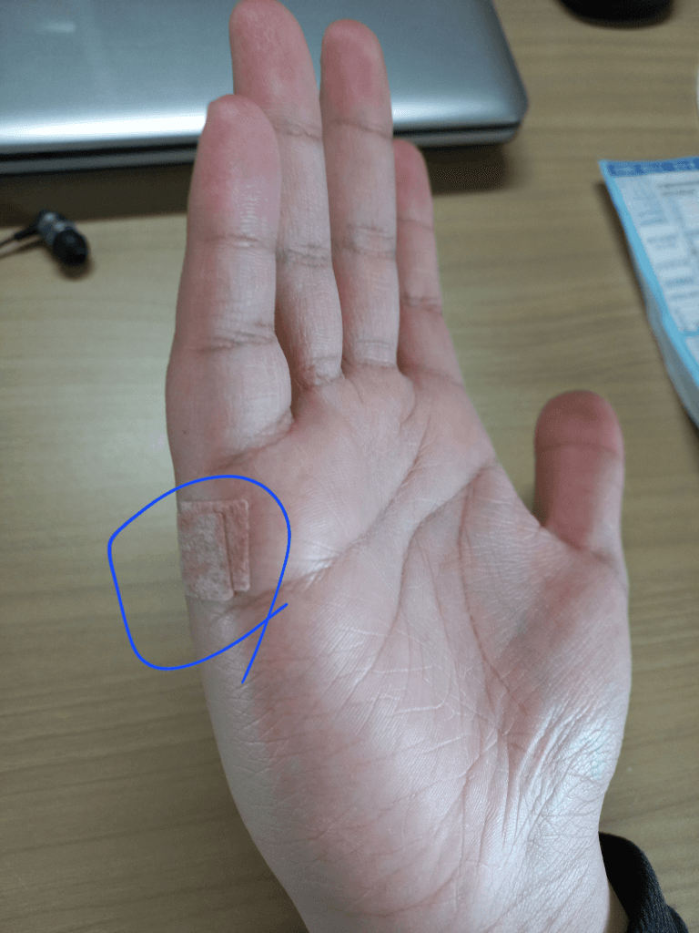 2번 째 사진
