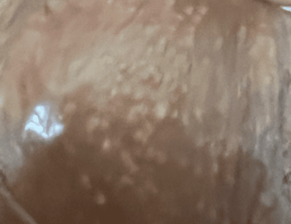 2번 째 사진
