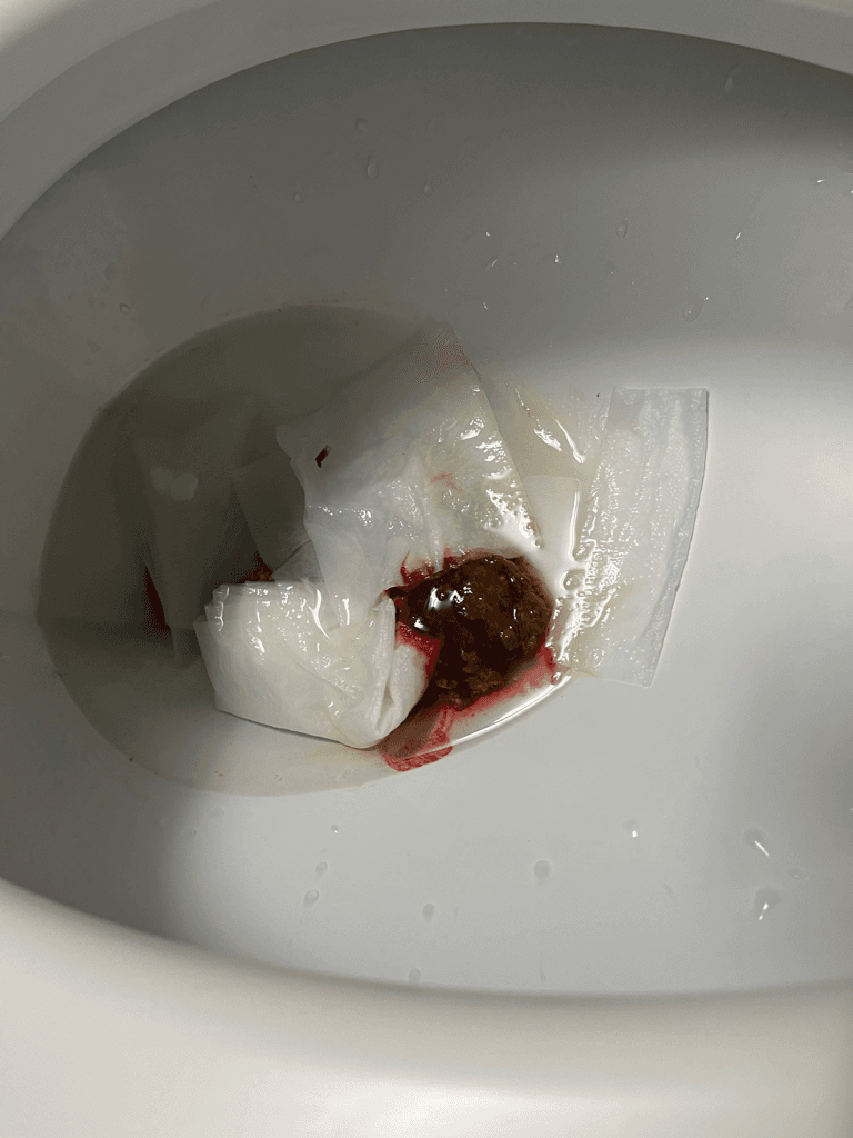 2번 째 사진