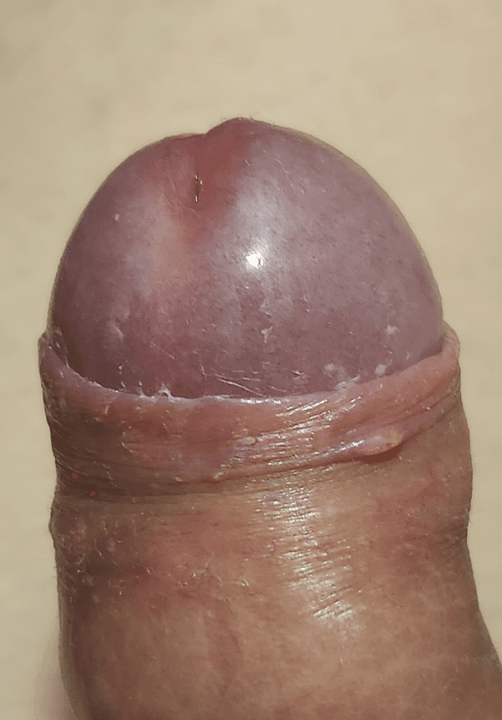 2번 째 사진