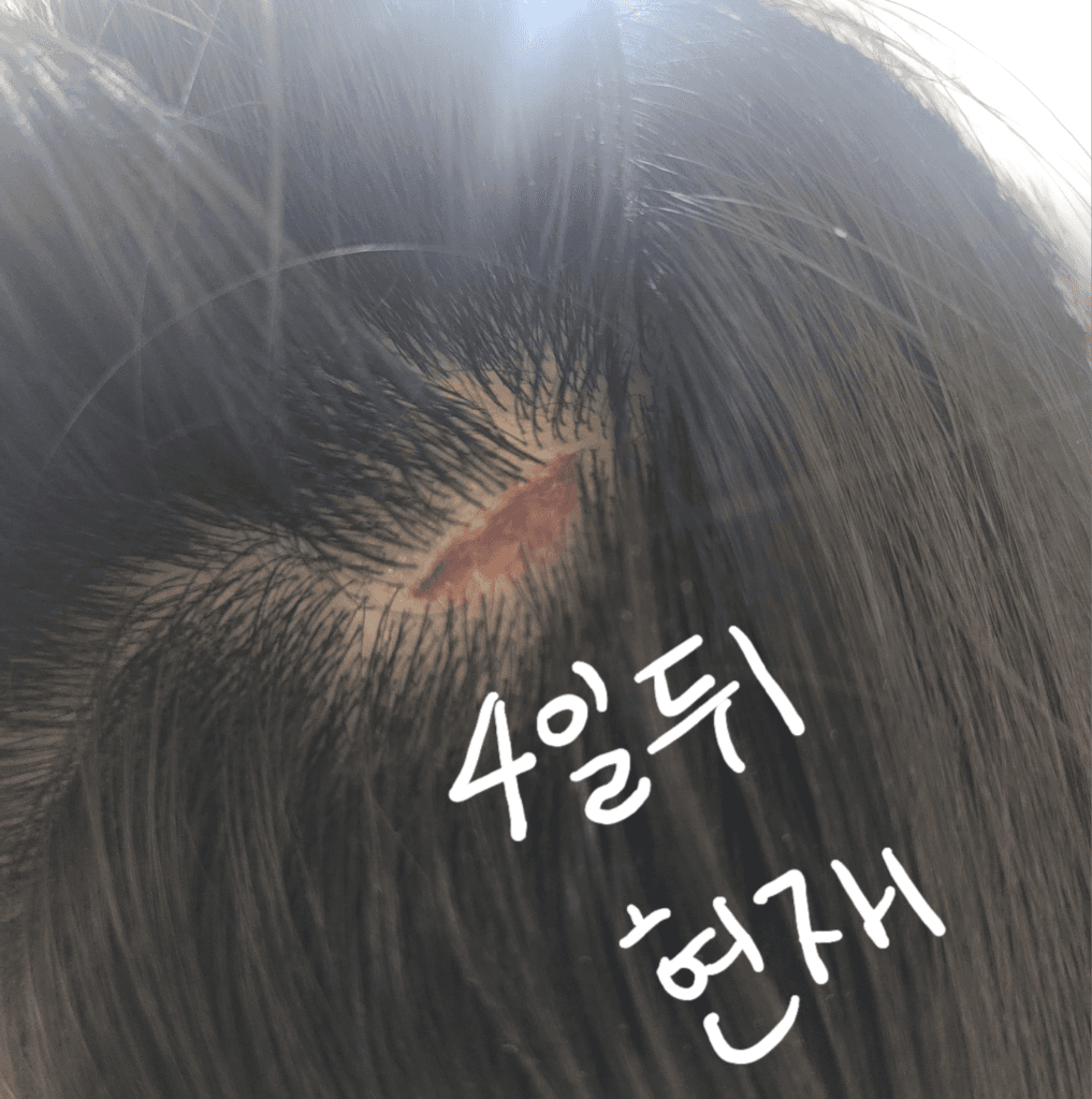 4번 째 사진