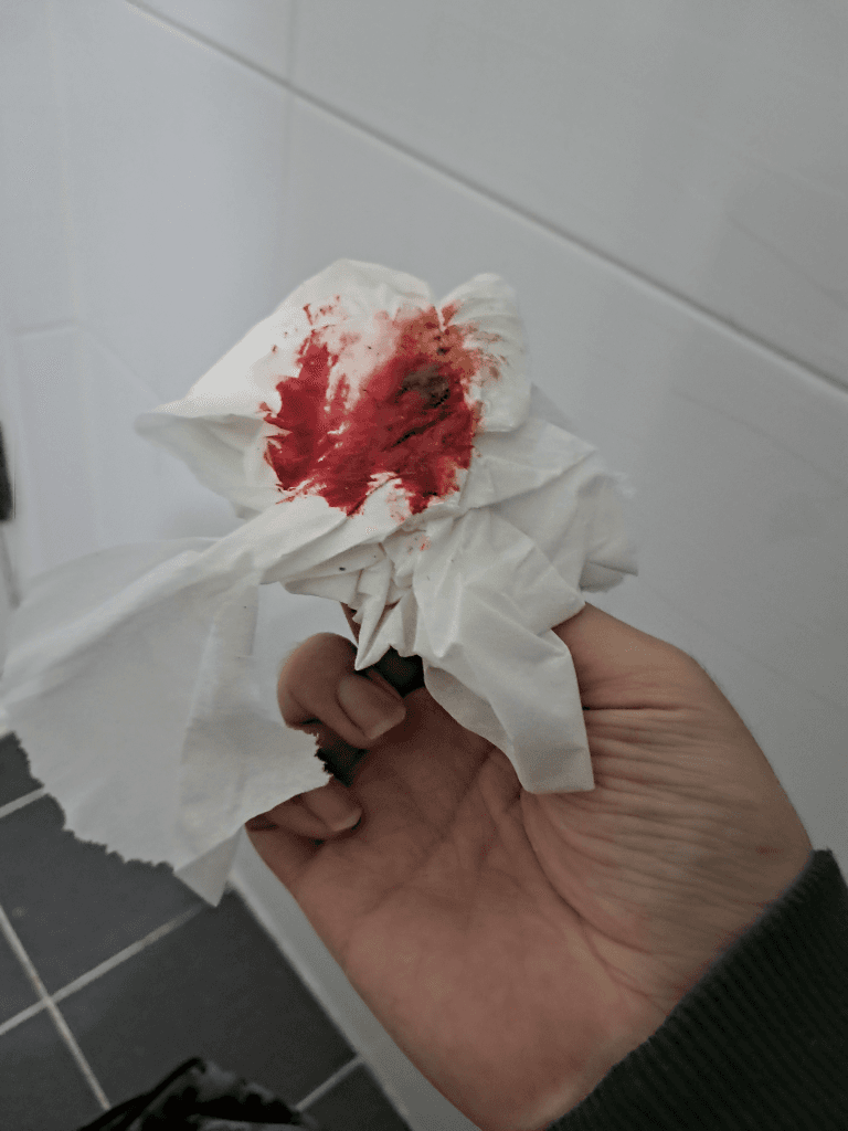 3번 째 사진