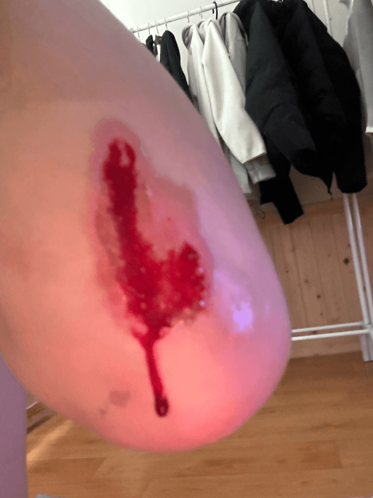 1번 째 사진