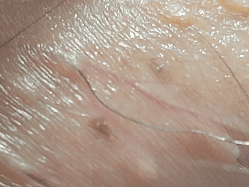 6번 째 사진