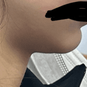 3번 째 사진