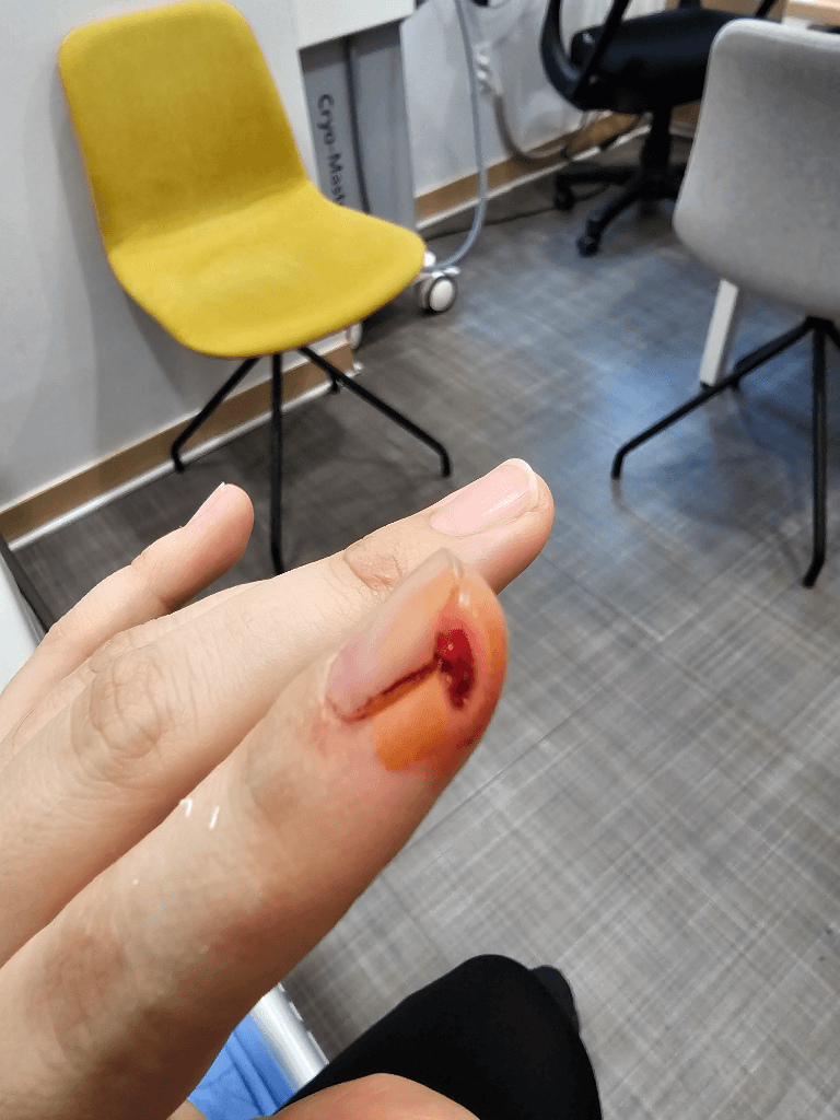 1번 째 사진